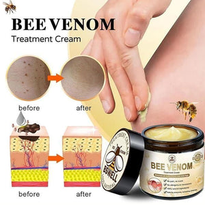 Bee Venom Skin Treatment Cream 100g (Pack of 1)