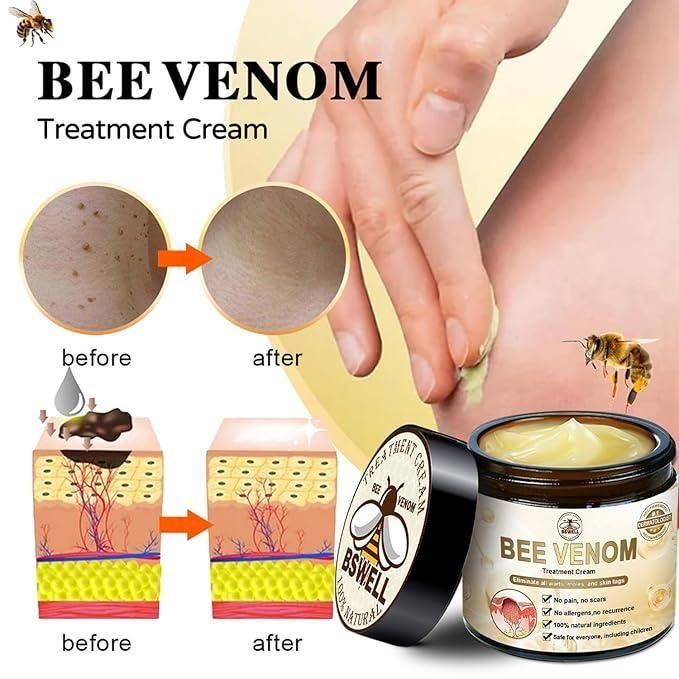 Bee Venom Skin Treatment Cream 100g (Pack of 1)