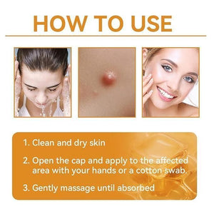 Bee Venom Skin Treatment Cream 100g (Pack of 1)