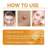 Bee Venom Skin Treatment Cream 100g (Pack of 1)